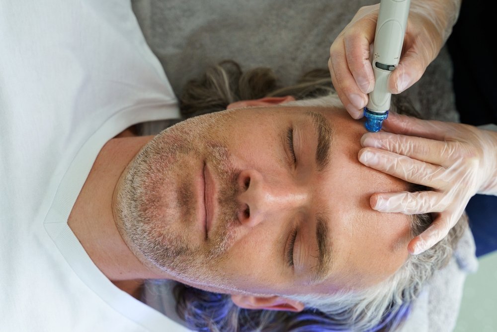 How HydraFacial Benefits Men’s Skincare Routine